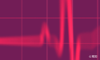心電図