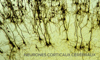 cerebral cortical neurons