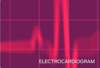 electrocardiogram
