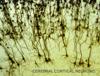 Explore_areas_of_brain_health