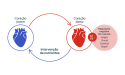 gráfico do coração idoso