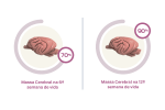 massa cerebral adulta