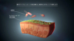 腸内微生物叢は病原体に対するバリアとなる