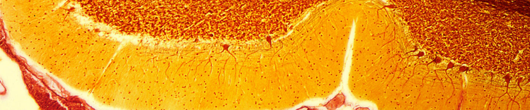 cellules de purkinje dans le cervelet