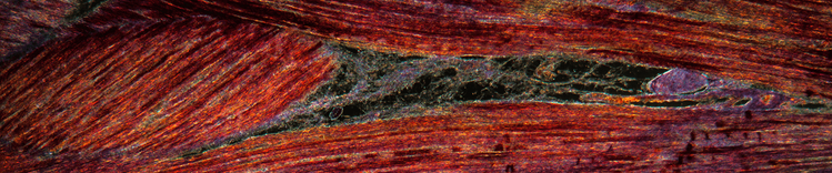 muscle tissue
