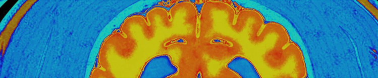 Purina Institute changements dans le vieillissement cérébral