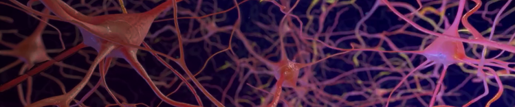 sindrome da disfunzione cognitiva