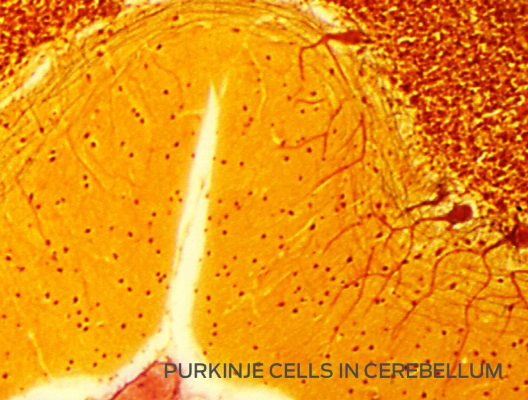The Aging Brain