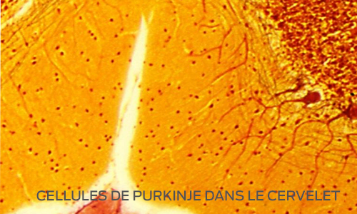 Le vieillissement du cerveau